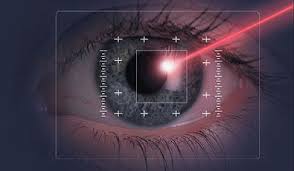 Lasik eye laser vision correction nearsighted