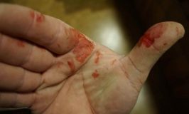 blood guts cut hand sharp knife